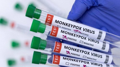 Variole du singe : plus de 5 000 cas confirmés dans le monde, annonce l’OMS