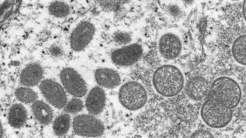 Argentine. Deux cas de variole du singe, premiers officiellement rapportés en Amérique latine