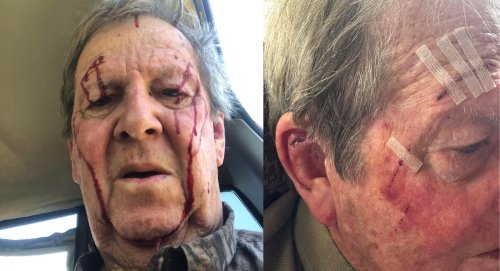 A Bobcat Mauled an 82-Year-Old Turkey Hunter. He Shrugged It Off