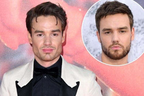 Cosmetic Surgery Experts Weigh In On Liam Payne’s Shocking New Look ...