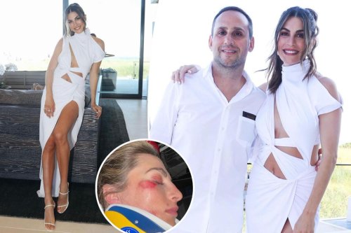 Michael Rubin’s girlfriend hospitalized after face-planting at epic July 4th bash
