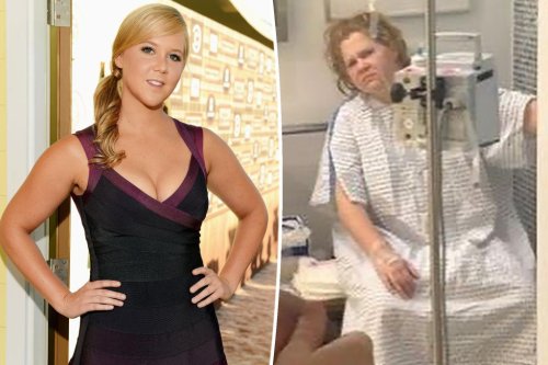 Amy Schumer warns 20-year-olds with before-and-after photos: ‘Life is coming for you’