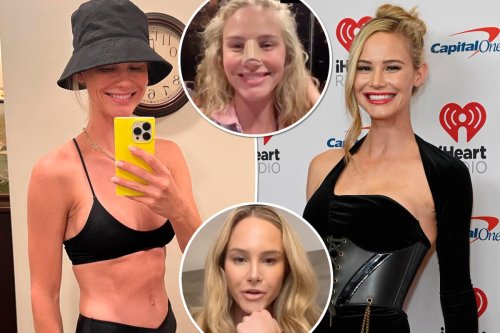 Meghan King shares recovery photos after nose and boob jobs: ‘what I wanted’