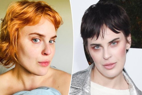 Tallulah Willis dissolves filler after six years, shows off ‘real bone structure’