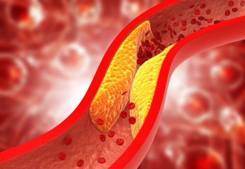 The #1 Way to Unclog Your Arteries Naturally, According to Cardiologists