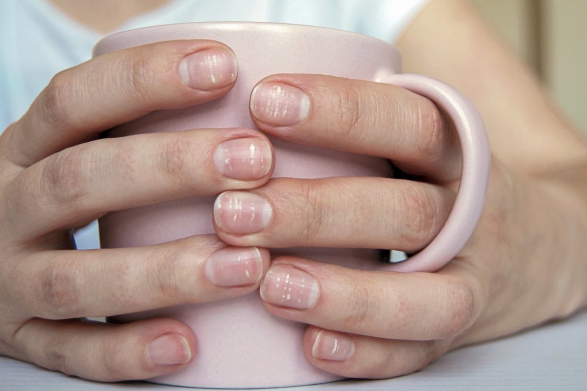 What Causes Those White Spots on Your Fingernails?
