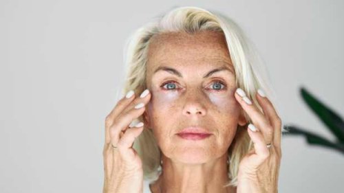 A Viral Dermatologist Revealed the Secret to Getting Rid of Dark Circles for Good