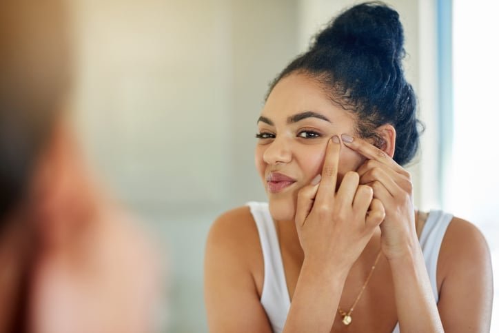 25 Greatest Pimple Popping Videos of All Time