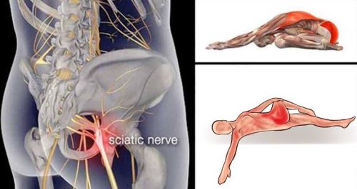 Local Event: 10 Piriformis Stretches To Get Rid Of Sciatica, Hip, And Lower Back Pain