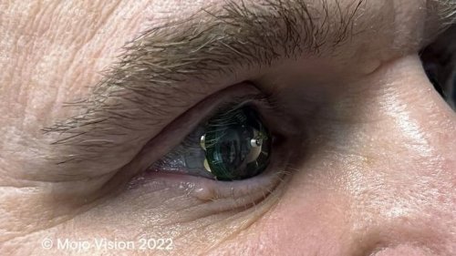 Mojo Vision Shows Off Functioning Smart Contact Lens