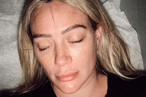 Pregnant Hilary Duff Gets Acupuncture as She Says She's 'Gently Trying to Give Baby the Eviction Notice'