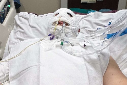 Idaho Man Suffers Third-Degree Burns and Is in a Coma After Freak Accident: 'I'm Dying! Please Help Me'