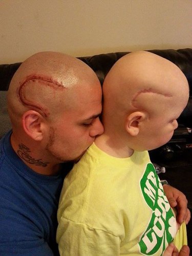 Dad Gets Scar Tattoo to Match His Son's Brain Cancer Surgery Scar: 'I Wanted to Take Away Some of the Stares'
