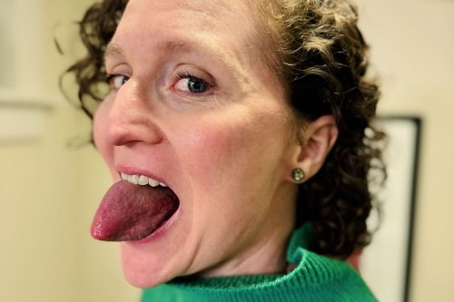 Woman with a Tongue That’s Wider Than a Soda Can Nabs World Record: 'It’s Pretty Weird Looking'