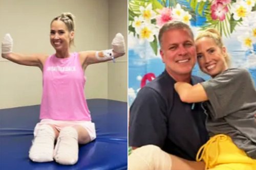 Texas Teacher Loses Arms and Legs After Sepsis 'Mummified' Her Limbs