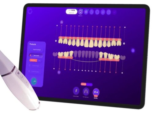 Fox 3D, une startup française qui utilise l'IA pour révolutionner les prothèses dentaires