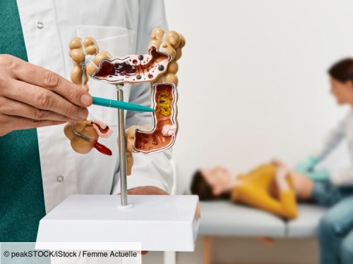 Cancer colorectal : en quoi consistent les différents tests et examens pour le dépister ?