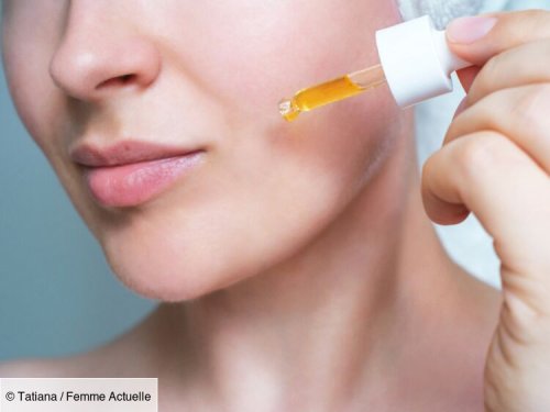 Taches brunes sur le visage : un dermatologue révèle l'ingrédient à utiliser et la forme à privilégier
