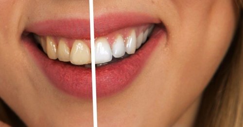 Comment blanchir ses dents sans produit chimique ?
