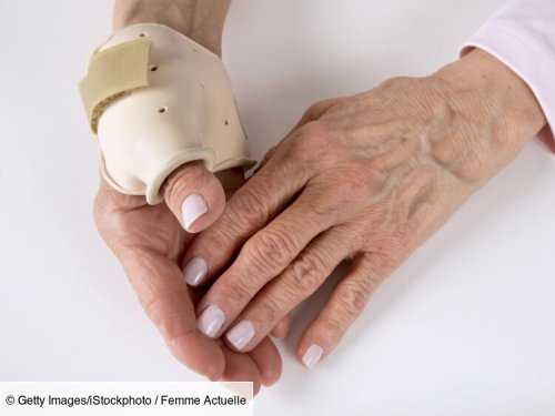 Arthrose des doigts : les bons traitements