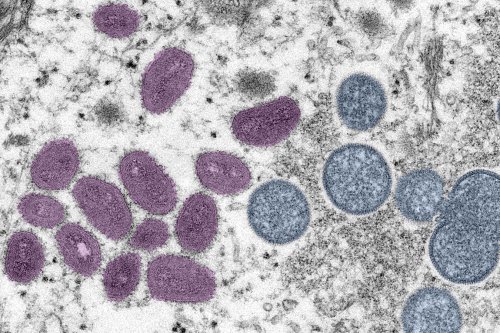 Technical bug bungles New York City's monkeypox vaccine rollout