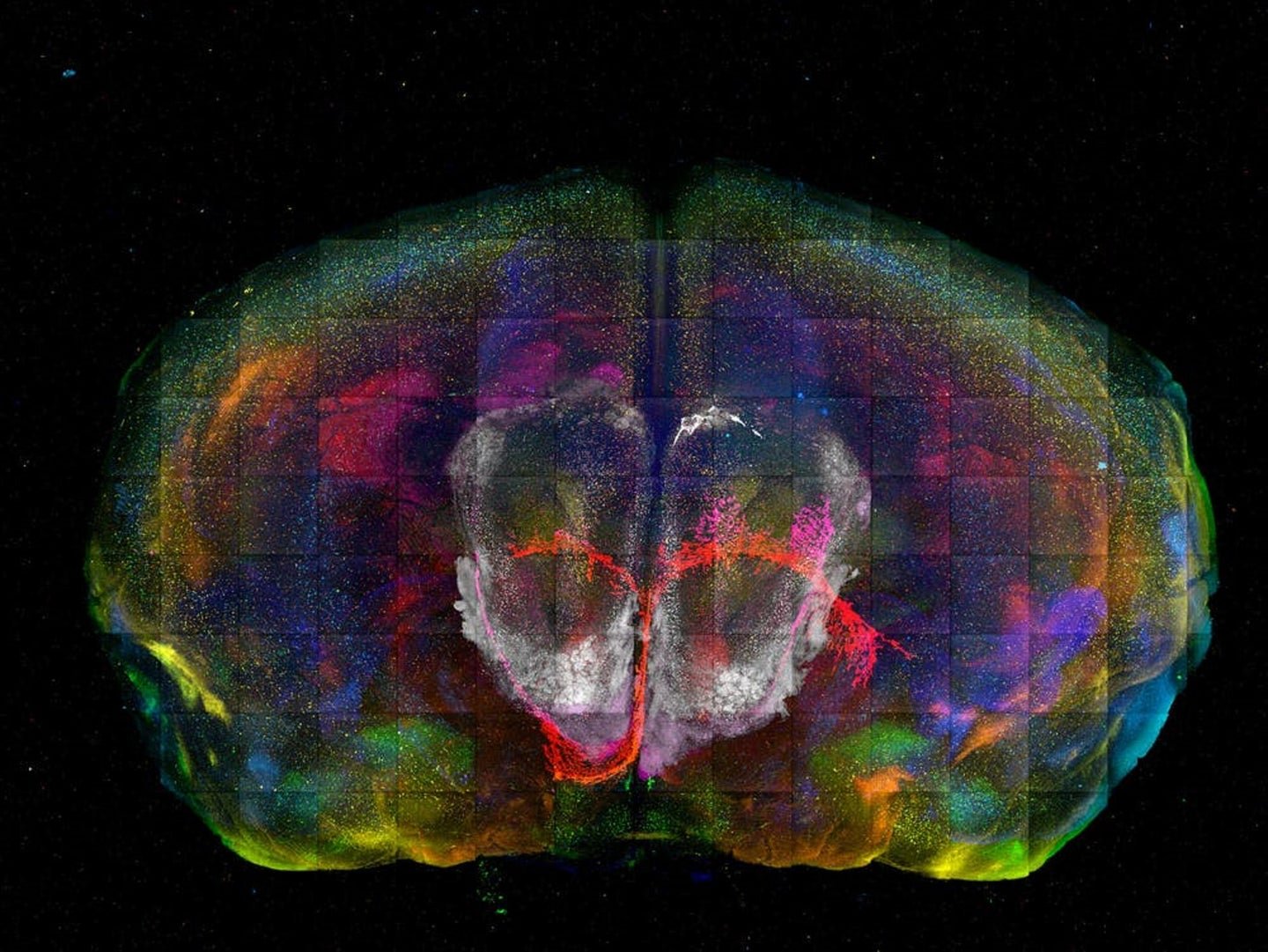 Neuroscientists are mapping all 100 billion cells in the human brain