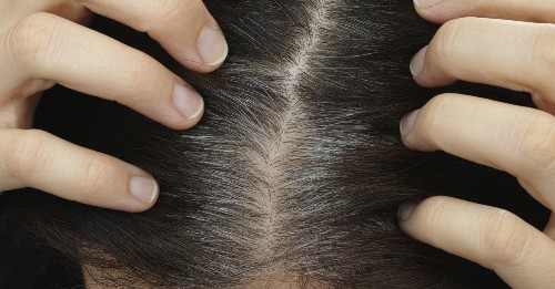 We finally know why stress makes you go gray
