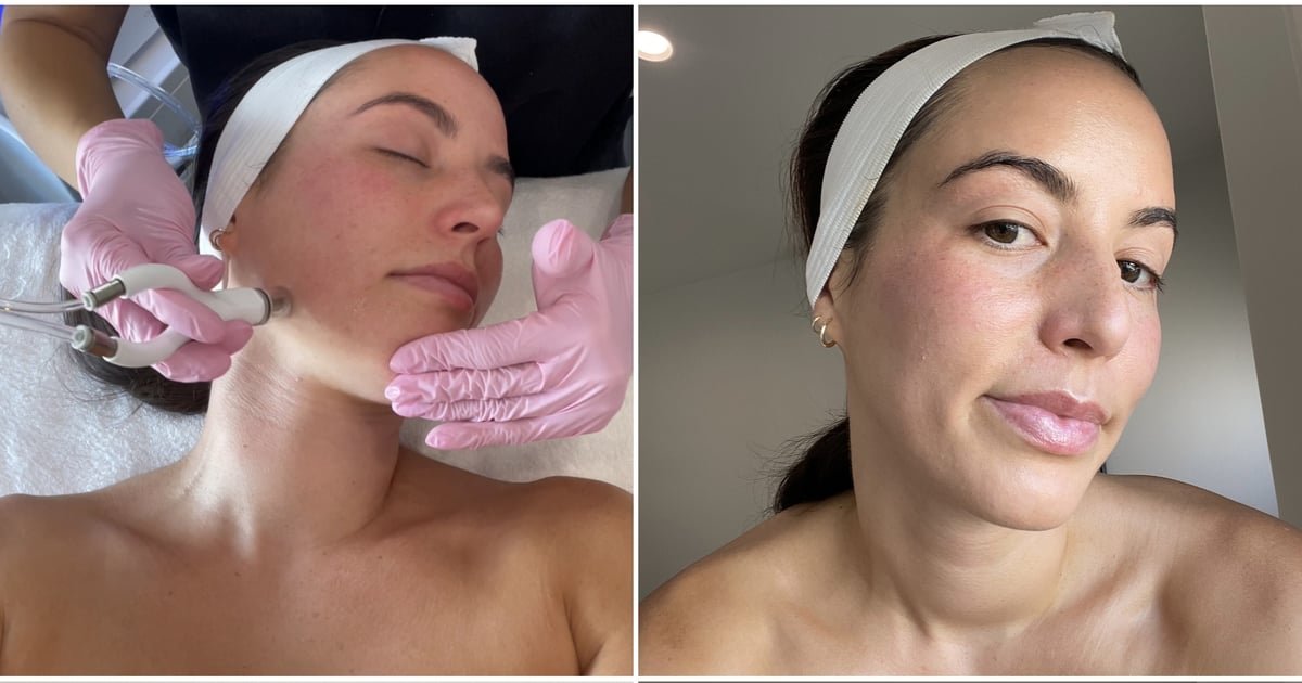 I Tried a $200 Celeb-Loved Facial, and My Skin Has Never Looked Better