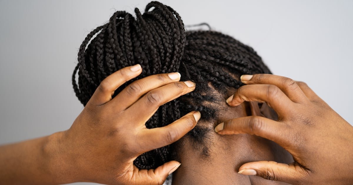 What Salicylic Acid Can Do For Your Scalp