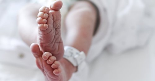 Why Are Preterm Births on the Rise in the US?