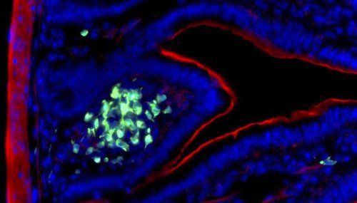 Un nouveau type de cellules immunitaires à mémoire découvert dans l’intestin