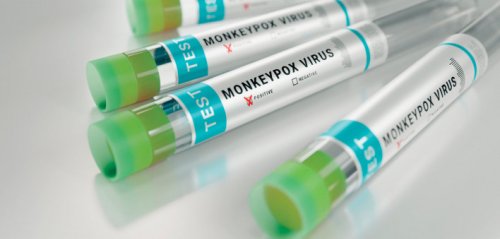 U.S. Will Lift Monkeypox Emergency Declaration