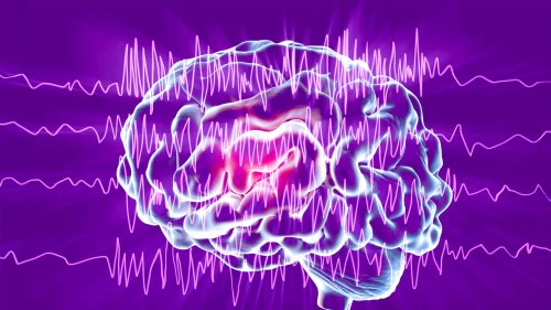 Mieux comprendre l’épilepsie : La chronique du Dr Gérald Kierzek