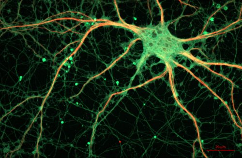 Traumatic brain injuries trigger neural network reorganization