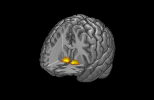 Neuroimaging study finds alterations in connectivity of brain areas can predict depression