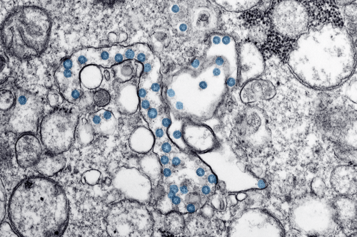 More COVID-19 Variant Cases Detected In Montana
