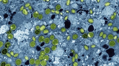 Cinq ans après le confinement : quels sont les nouveaux virus qui nous menacent ?