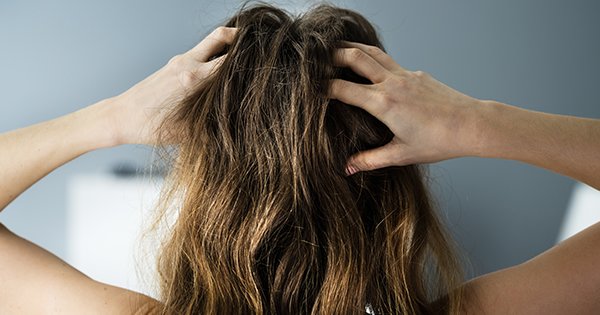 Looking for a Dry Scalp Treatment? Here are 18 Soothing Options