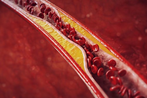 This simple snacking habit could improve your cholesterol levels: new study