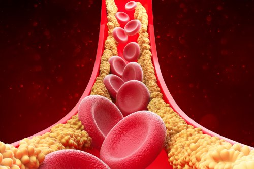 Here's what actually causes high cholesterol (and how to cut it) | BBC Science Focus Magazine