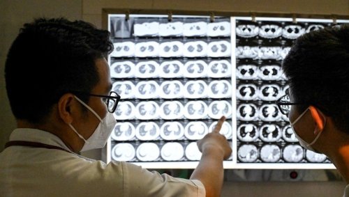 Usaid : sans l'aide internationale américaine, la menace de recrudescence de la tuberculose plane