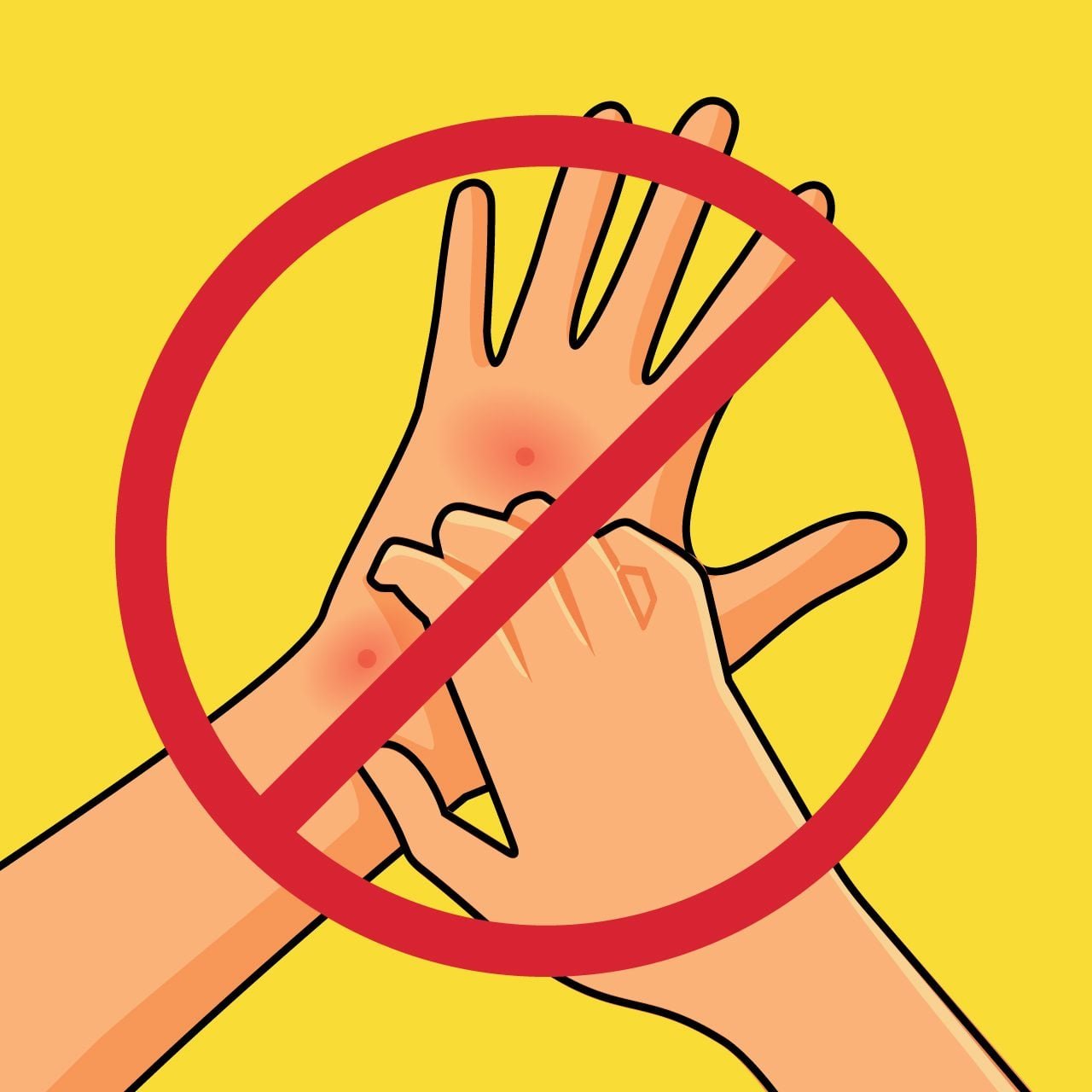 Don’t Scratch That Bug Bite or You Will Get *Much* Itchier! Here’s What to Do Instead