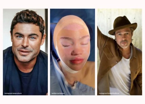 This Month in Aesthetics: Zac Efron Reveals Why His Face Looks So Different, Grimes Hints at Elf Ear Surgery, Brad Pitt Launches a $385 Serum, and More