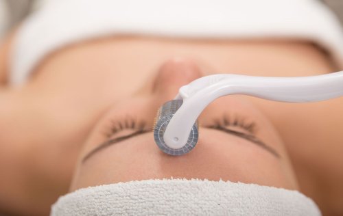 Everything You Ever Wanted to Know About Microneedling