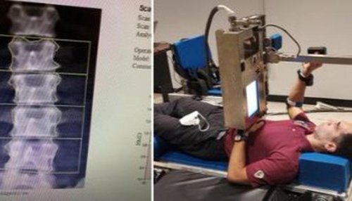 NASA's Raja Chari shares picture of his bent spine after spending 6 months aboard ISS
