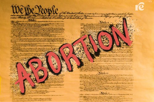 Why We Need a Constitutional Amendment for Abortion Rights