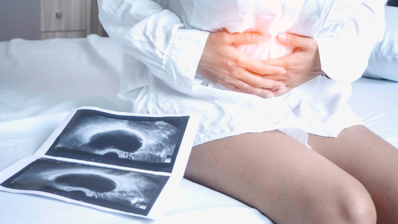 Priorité santé - Endométriose: quand faut-il s'inquiéter et aller consulter?