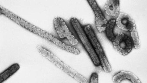 Virus de Marburg: ce qu'il faut savoir de cet agent pathogène cousin d'Ebola