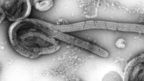 La Tanzanie confirme cinq morts du virus de Marburg dans le pays
