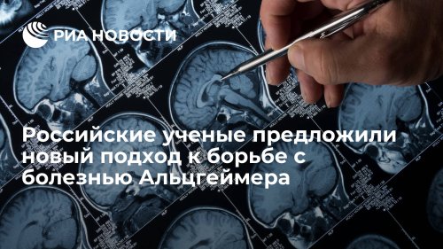 Российские ученые предложили новый подход к борьбе с болезнью Альцгеймера